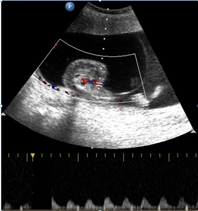 Click here to view Large Image