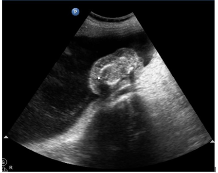 Click here to view Large Image